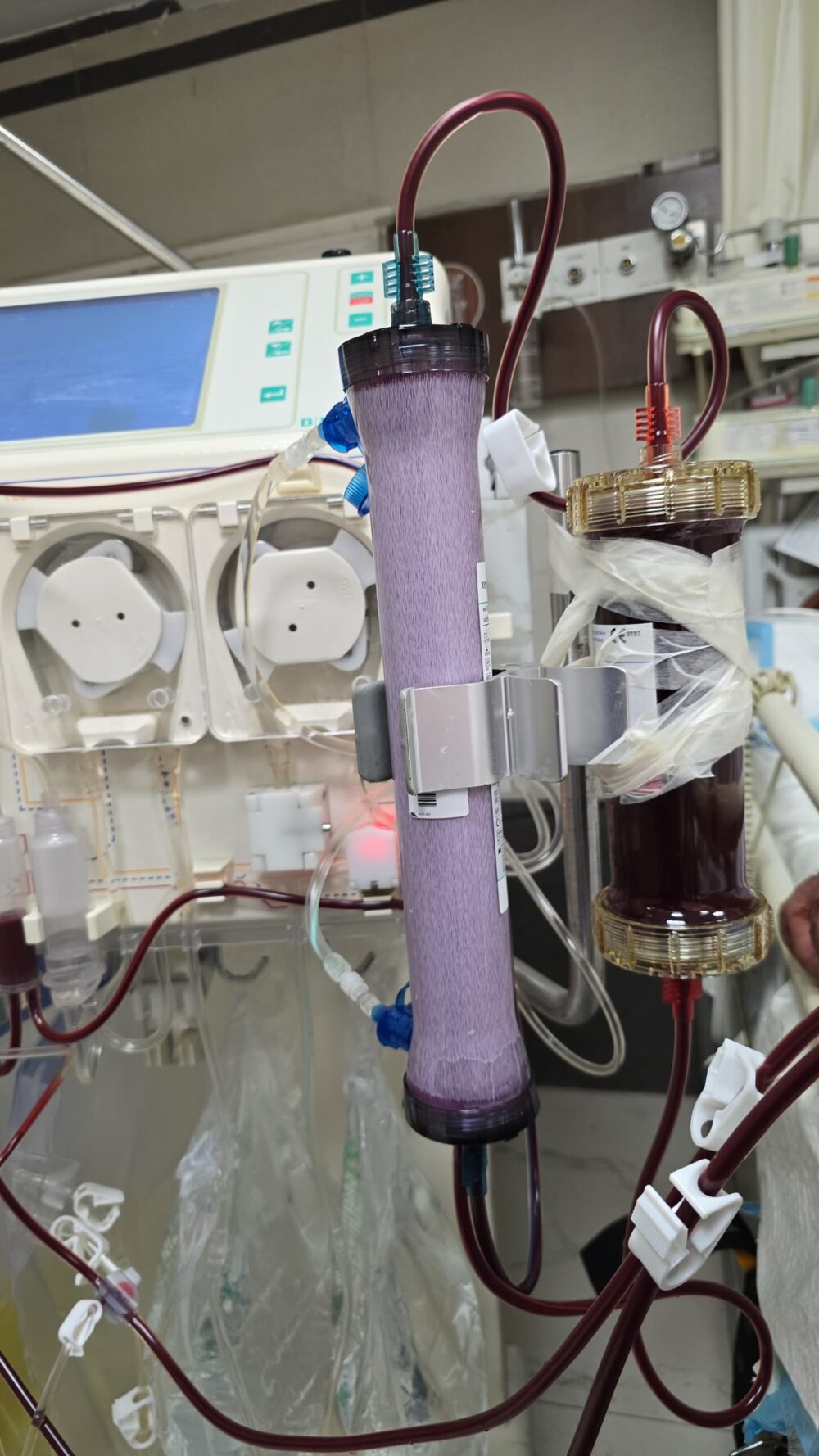 Hemoperfusion - Image 5