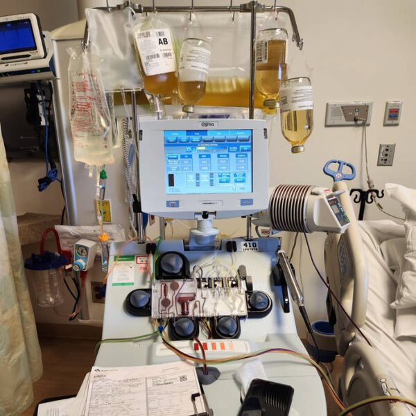 Plasmapheresis