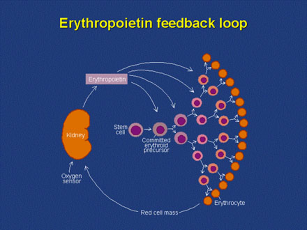 CKD طبقه بندی انواع آنمی در بیمارانبر اساس اتیولوژی