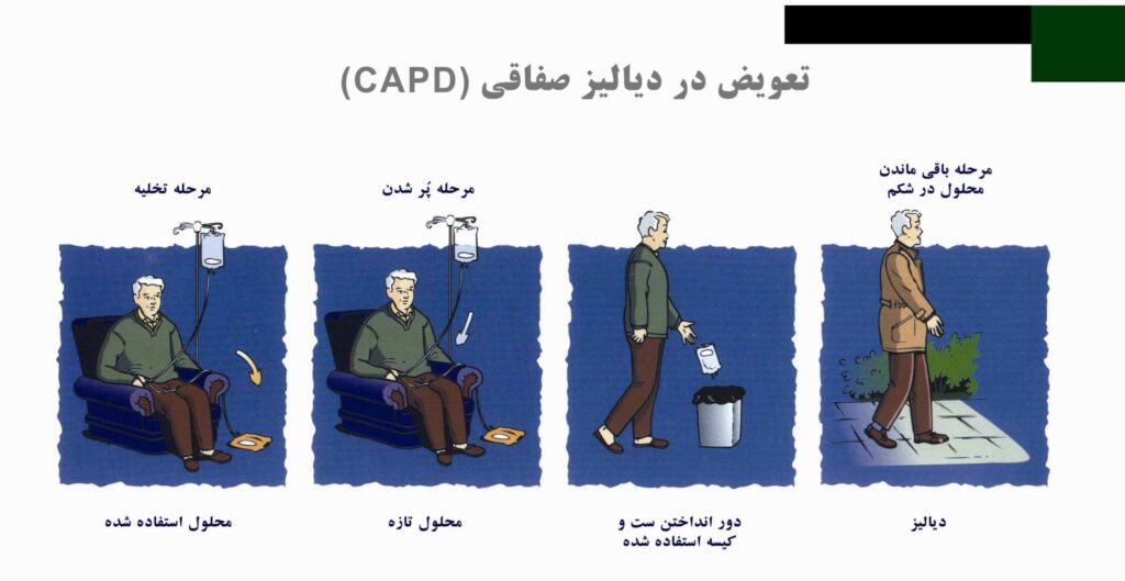 دیالیز صفاقی