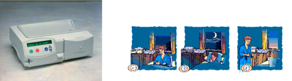 APD: دیالیز صفاقی خودکار