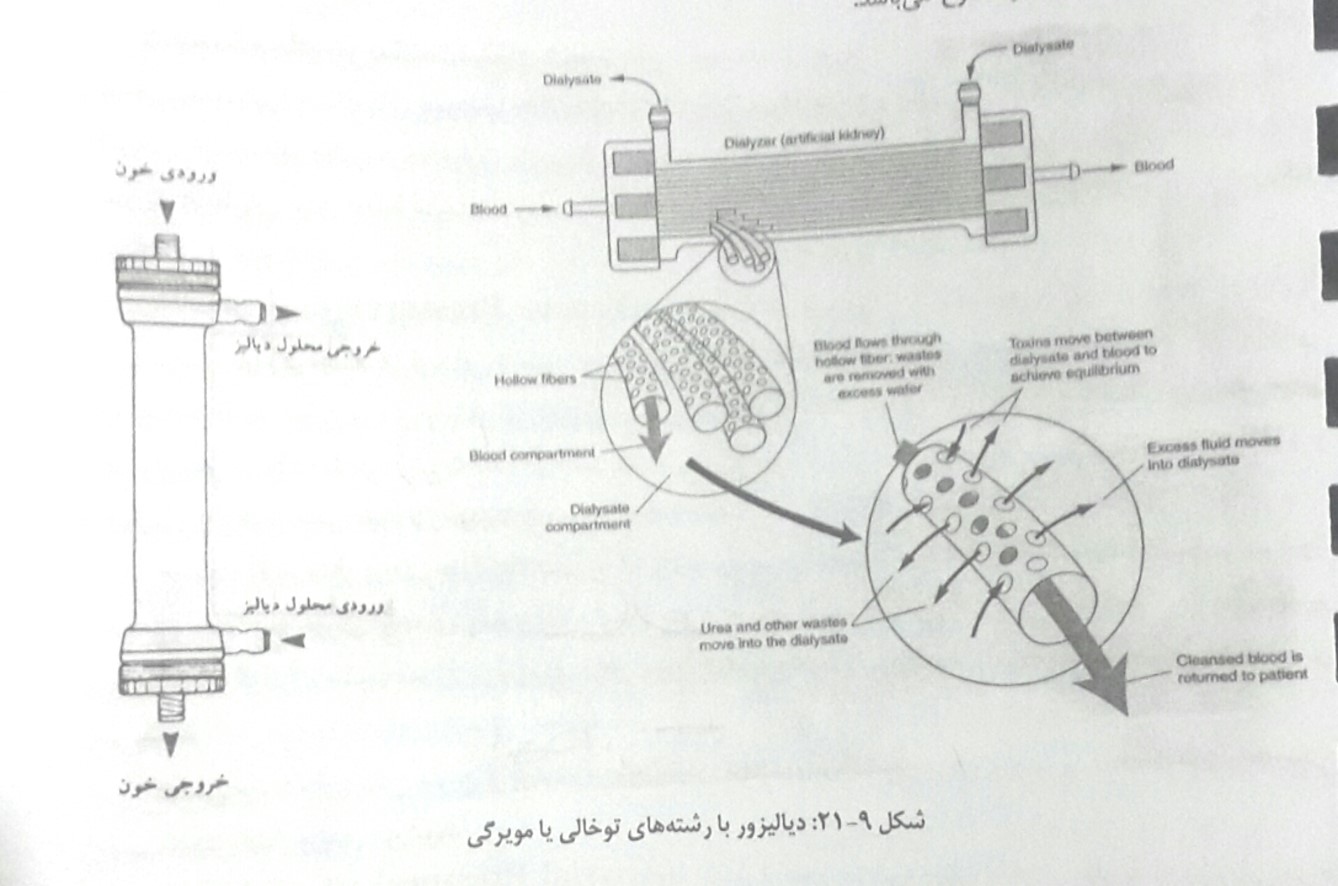 دیالیزور با رشته های توخالی یا مویرگی
