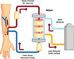 راهنمای خود مراقبتی در بیماران همودیالیز