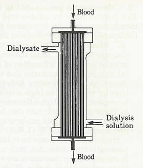 mechanisms of solute removal