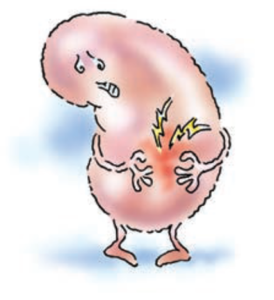 نارسایی حاد کلیه