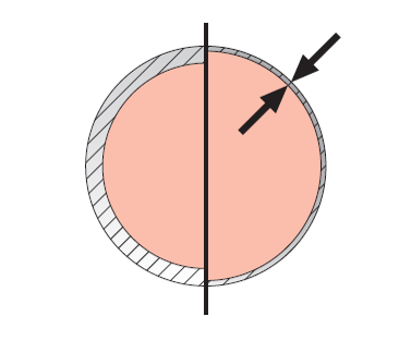 شاخص های کیفی سوزن فیستولا