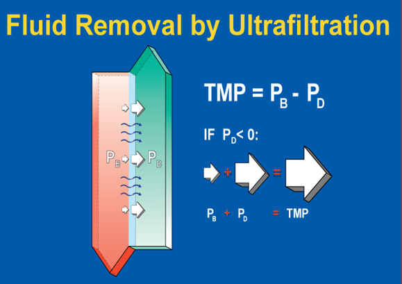 fluid removal by ultrafiltration's