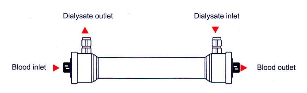 شاخص های کیفی صافی دیالیز