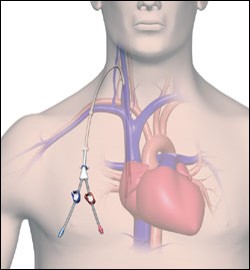 Polyurethane, Polyethylene, Polythetrafluoroethylene