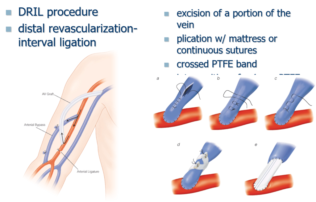 درمان جراحی ایسکمی اندام