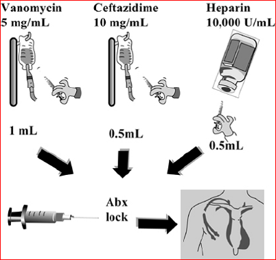 قفل آنتی بیوتیکی