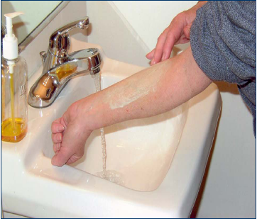 نحوه تزریق سوزن