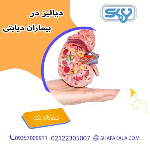 دیالیز در بیماران دیابتی