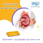علائم اولیه نارسایی کلیه که نباید نادیده گرفته شود