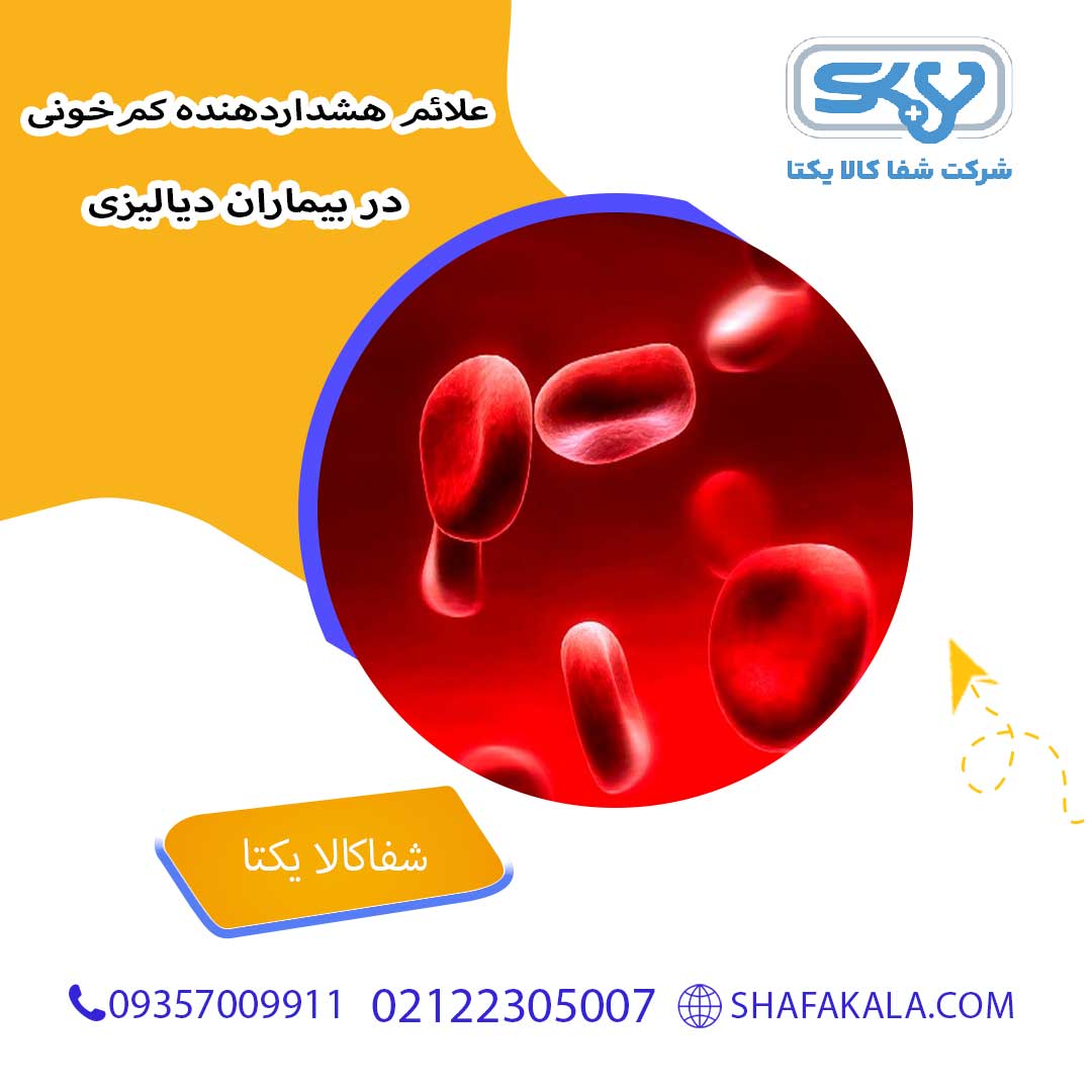 علائم هشداردهنده کم‌خونی در بیماران دیالیزی