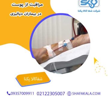 مراقبت از پوست در بیماران دیالیزی