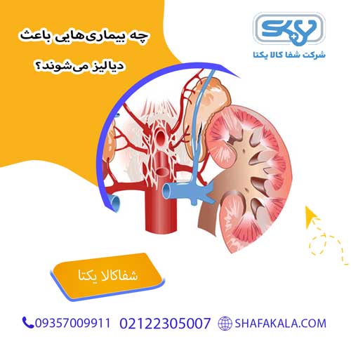 چه بیماری‌هایی باعث دیالیز می‌شوند؟